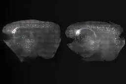 بهبود آلزایمر با کمک تحریک امواج مغزی