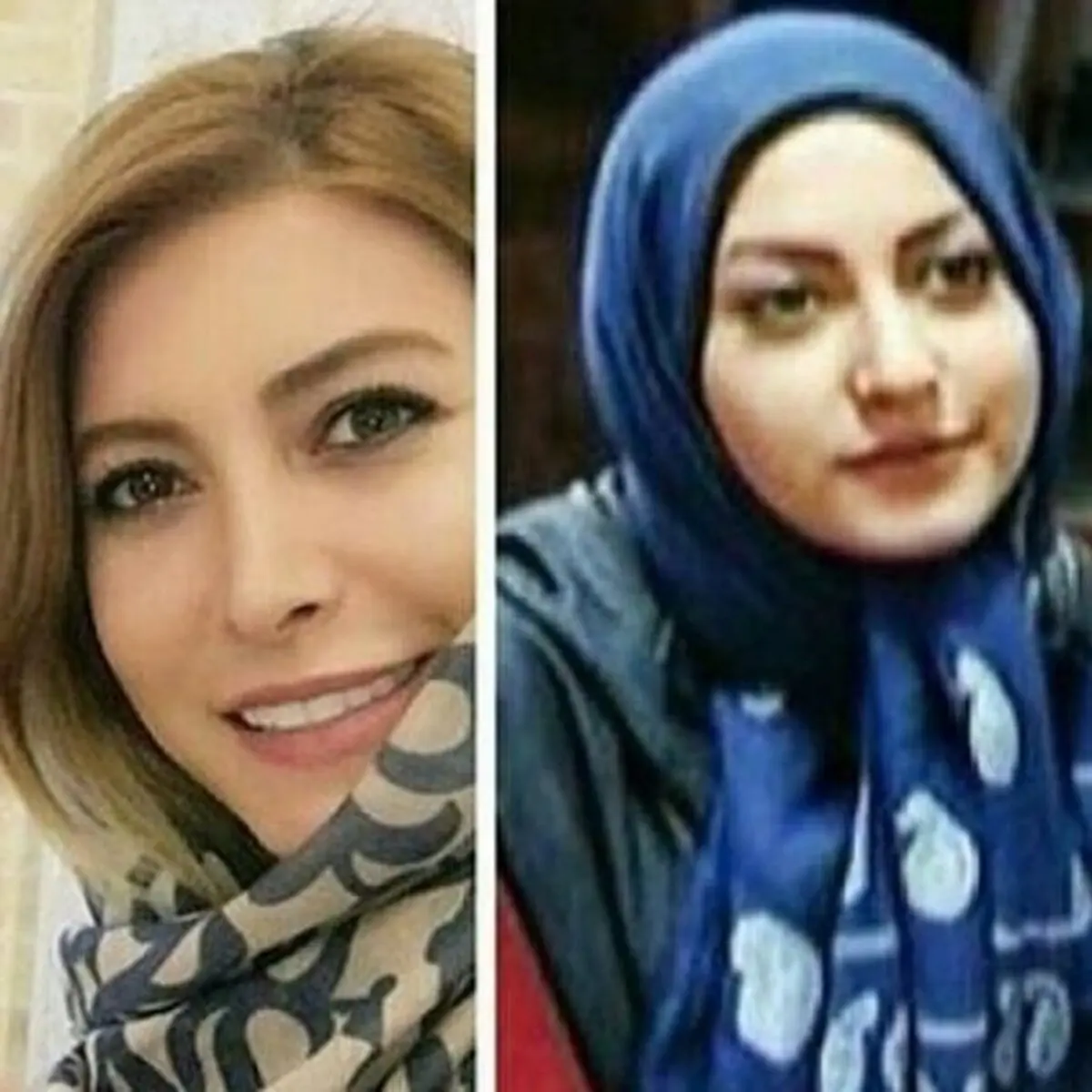 چهره متفاوت فریبا نادری قبل و بعد از جراحی زیبایی بینی!! عکس