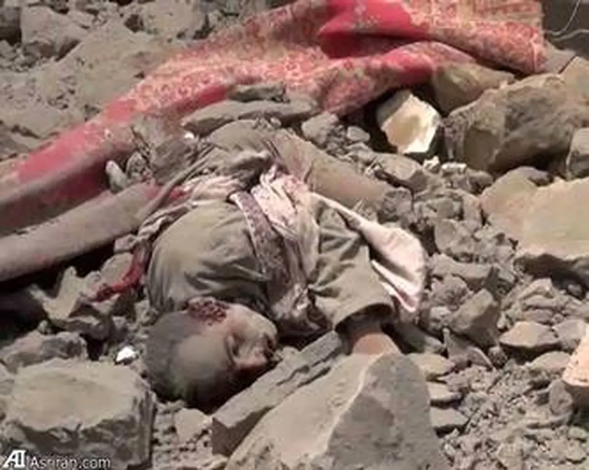 تصاویر جنایات آل سعود در یمن(18+)