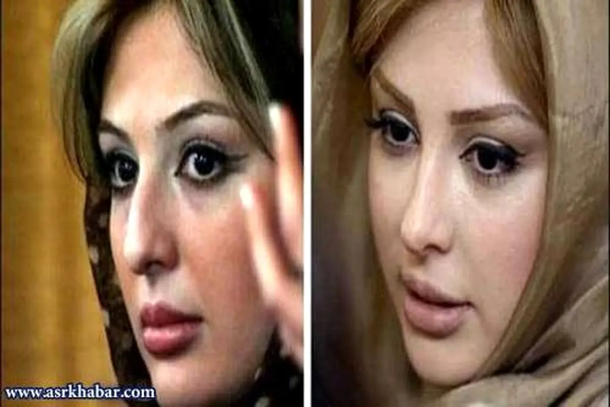 تفاوت چهره بازیگران زن ایرانی، قبل و بعد از عمل زیبایی/تصاویر