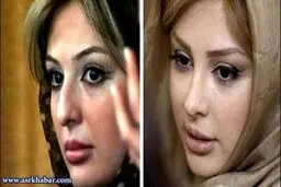 تفاوت چهره بازیگران زن ایرانی، قبل و بعد از عمل زیبایی/تصاویر