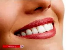 با شرکت در کمپین دکتر داوودیان لبخند زیبا داشته باشید