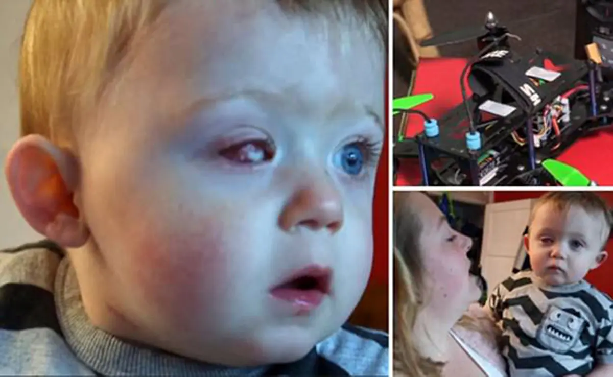 هدیه تولدی که چشم کودک را کور کرد + تصاویر