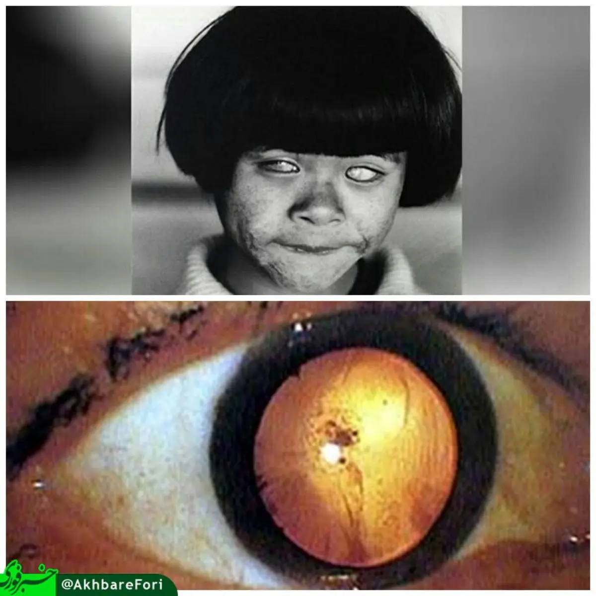 دختری با چشمانی هیولایی/عکس