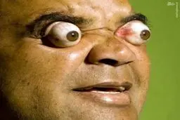 مردی که چشمانش را 4 سانتی متر بیرون می آورد/عکس