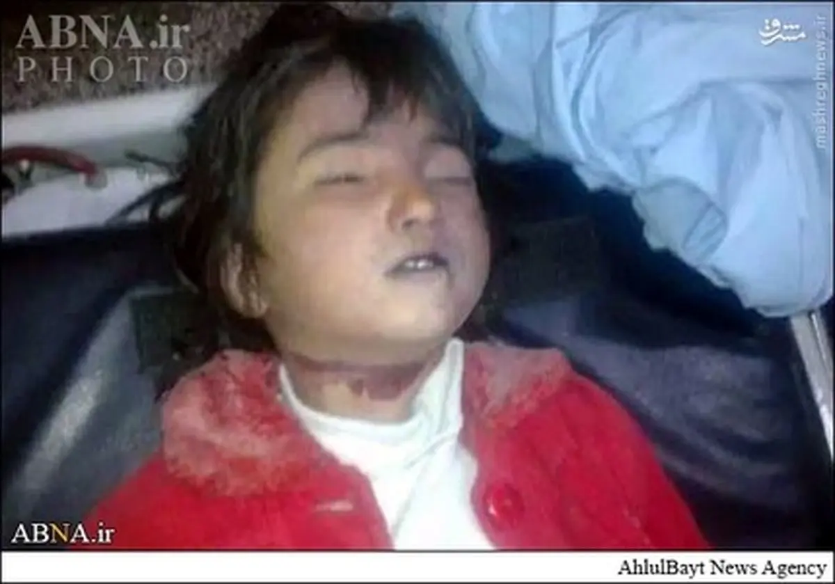 تصاویر دردناک ذبح‌ دختر  شش ساله در شهر کویته