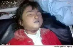 تصاویر دردناک ذبح‌ دختر  شش ساله در شهر کویته