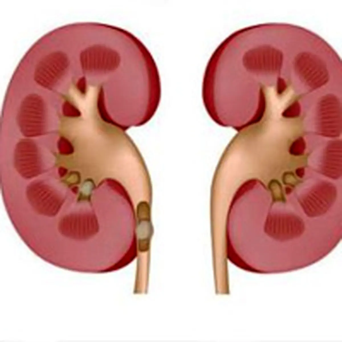 وزارت بهداشت جلوی قاچاق عضو در یک بیمارستان تهران را گرفت