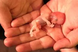 سقط جنین زیرپله ای با 4.5 میلیون!