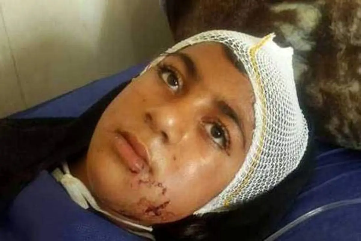 دختری که سگ وحشی را از پای درآورد +عکس