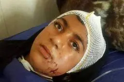 دختری که سگ وحشی را از پای درآورد +عکس