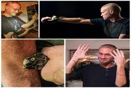 مردی که بدنش پادزهر میسازد / عکس