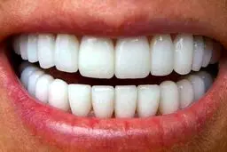 خوراکی‌های زردکننده دندان