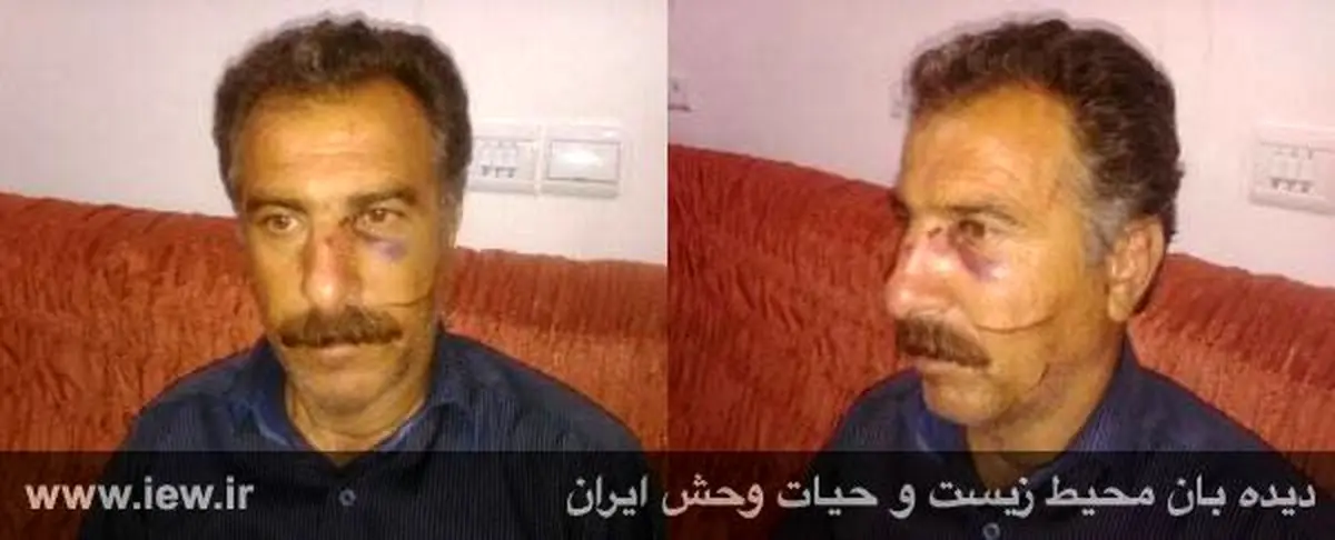 ضرب و شتم محیط بان ایلامی توسط شکارچیان (+عکس)