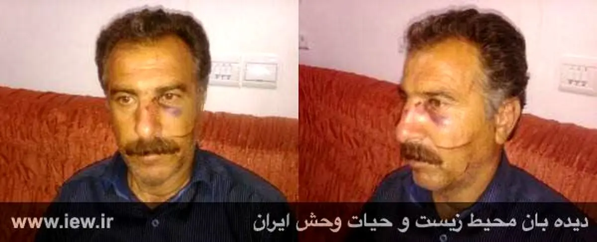 ضرب و شتم محیط بان ایلامی توسط شکارچیان (+عکس)