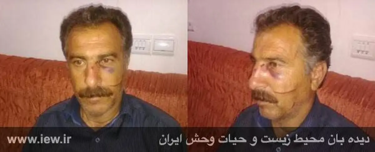 ضرب و شتم محیط بان ایلامی توسط شکارچیان (+عکس)