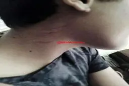 پدر دانش آموز:‌ مدير مدرسه فرزند 14ساله ام را كتك زد+عكس