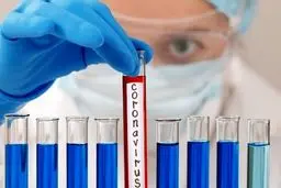 خبر خوب / دسترسی به واکسن کرونا تا اواسط مرداد + جزئیات