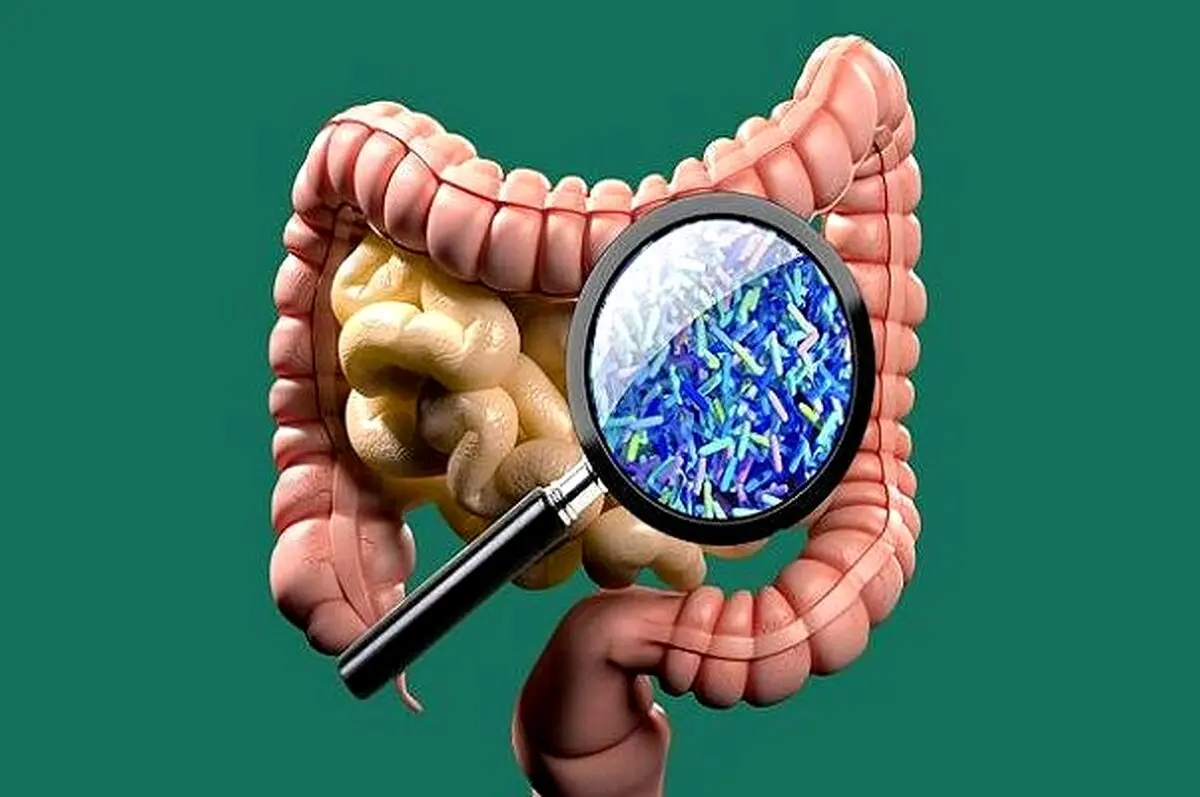 عدم تعادل باکتری های روده موجب بروز سکته و زوال عقل می شود