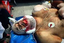 اولین عکس از فریدون قنبری قهرمان کشتی در بیمارستان!