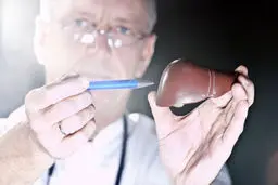 اگر این ۸ نشانه را دارید، کبد شما سمی شده است!