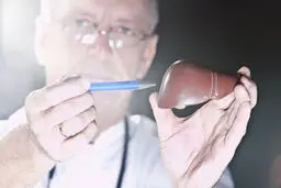 اگر این ۸ نشانه را دارید، کبد شما سمی شده است!