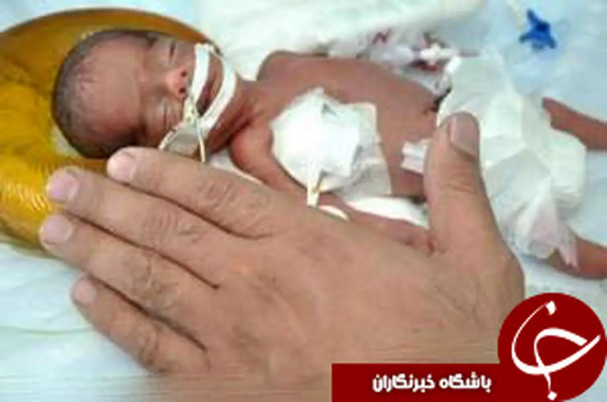 تولد نوزادی به اندازه کف دست+عکس