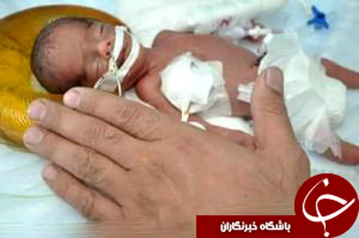 تولد نوزادی به اندازه کف دست+عکس