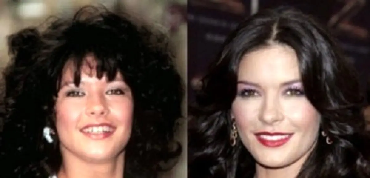 معروف ترین افرادی که لبخندشان را جراحی پلاستیک کرده اند + تصاویر