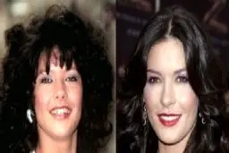 معروف ترین افرادی که لبخندشان را جراحی پلاستیک کرده اند + تصاویر