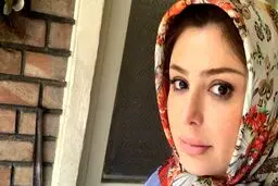 صورت خون آلود نیوشا ضیغمی