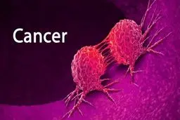 ایران سومین کشور دنیا در ژن‌درمانی سرطان خون