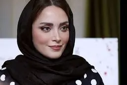 عکس چاقی شدید بهنوش طباطبایی قبل از عمل| تغییر چهره عجیب بهنوش طباطبایی بعد از طلاق