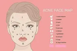 جوش‌های صورت زنگ خطر ابتلا به چه بیماری‌هایی هستند؟