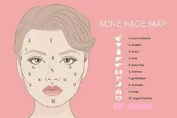 جوش‌های صورت زنگ خطر ابتلا به چه بیماری‌هایی هستند؟