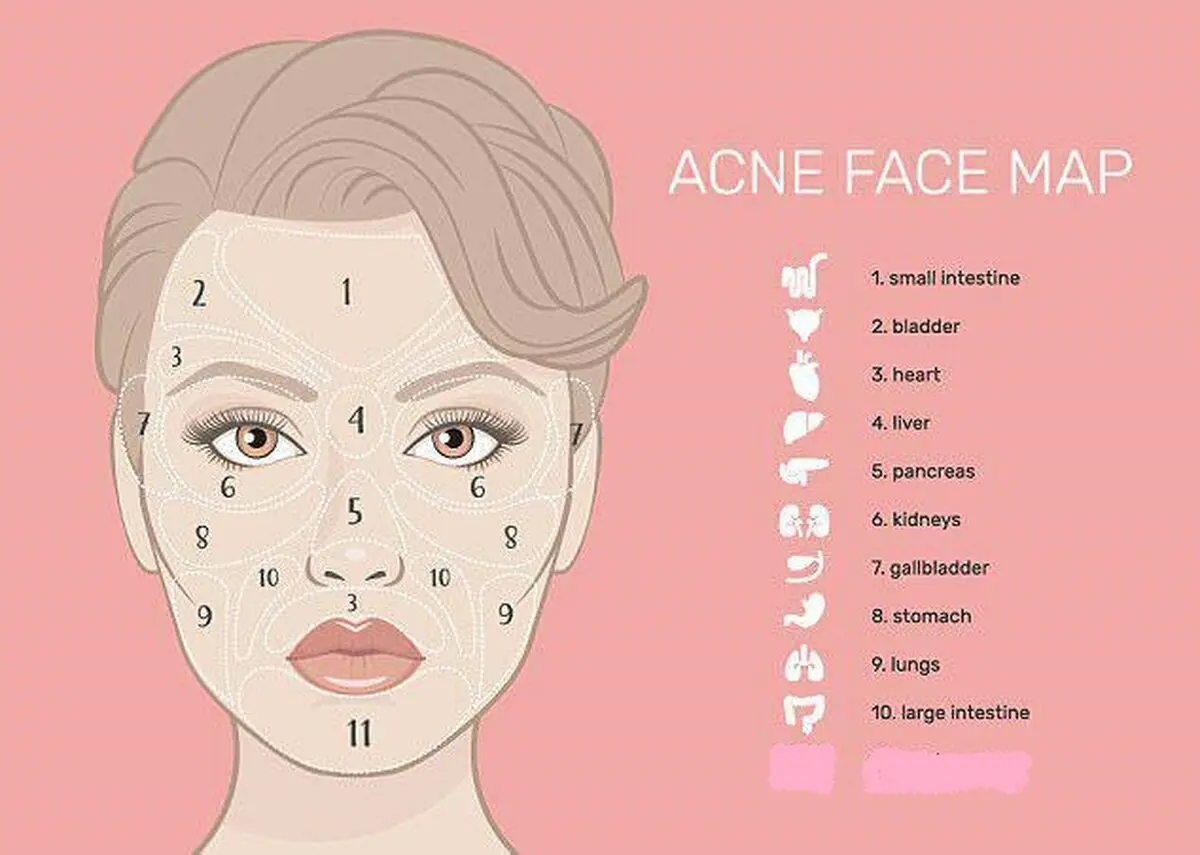 جوش‌های صورت زنگ خطر ابتلا به چه بیماری‌هایی هستند؟