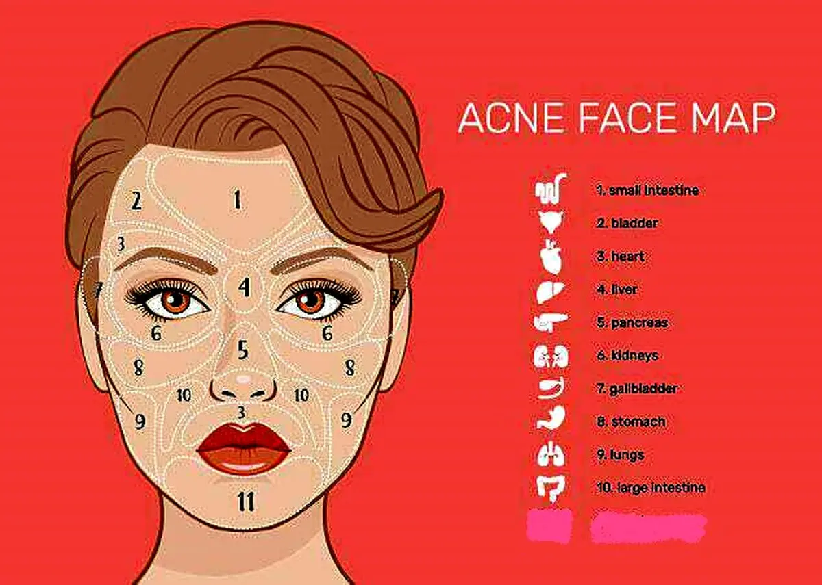 جوش‌های صورت زنگ خطر ابتلا به چه بیماری‌هایی هستند؟
