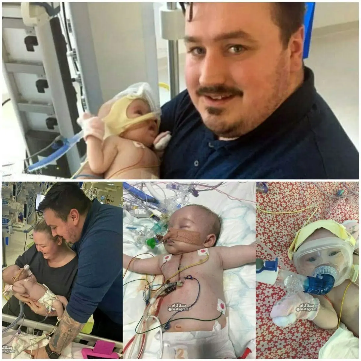 بچه شش ماهه ای که کرونا را شکست داد! + عکس