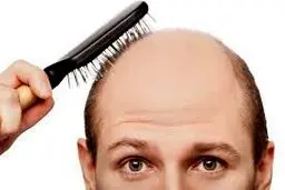 نسخه طب سنتی برای درمان ریزش مو چیست؟