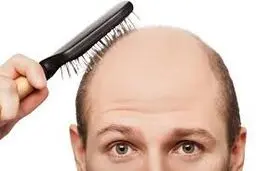 نسخه طب سنتی برای درمان ریزش مو چیست؟