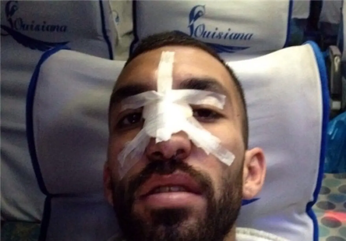 عکسی از بینی شکسته هافبک استقلال