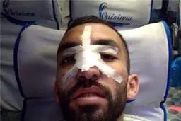 عکسی از بینی شکسته هافبک استقلال