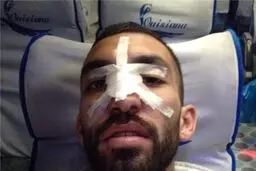 عکسی از بینی شکسته هافبک استقلال