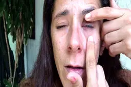 وقتی چسب قطره‌ای با قطره چشم اشتباه گرفته شود + تصاویر