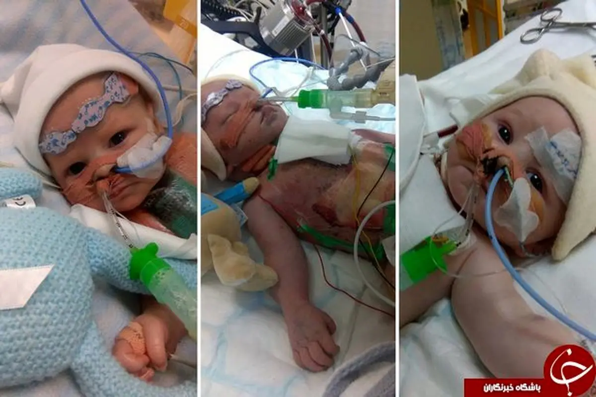 دختری که با قلب نصفه به دنیا آمد و باعث حیرت پزشکان شد+تصاویر