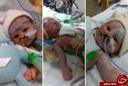 دختری که با قلب نصفه به دنیا آمد و باعث حیرت پزشکان شد+تصاویر