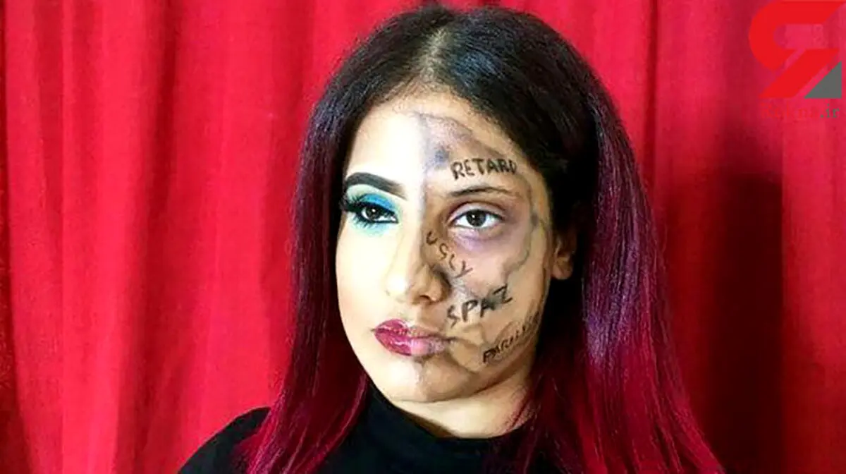 دختر معلولی که کلمات آزار دهنده را روی صورتش نوشت + عکس