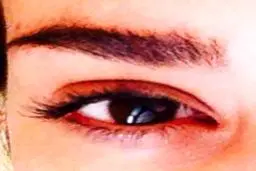 مشکل چشمی خانم بازیگر ایرانی +عکس