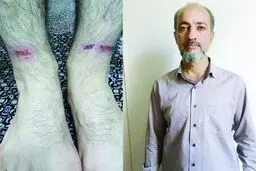 فرار گروگان 800 میلیونی از اسارتگاه مخوف