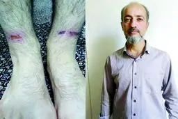 فرار گروگان 800 میلیونی از اسارتگاه مخوف